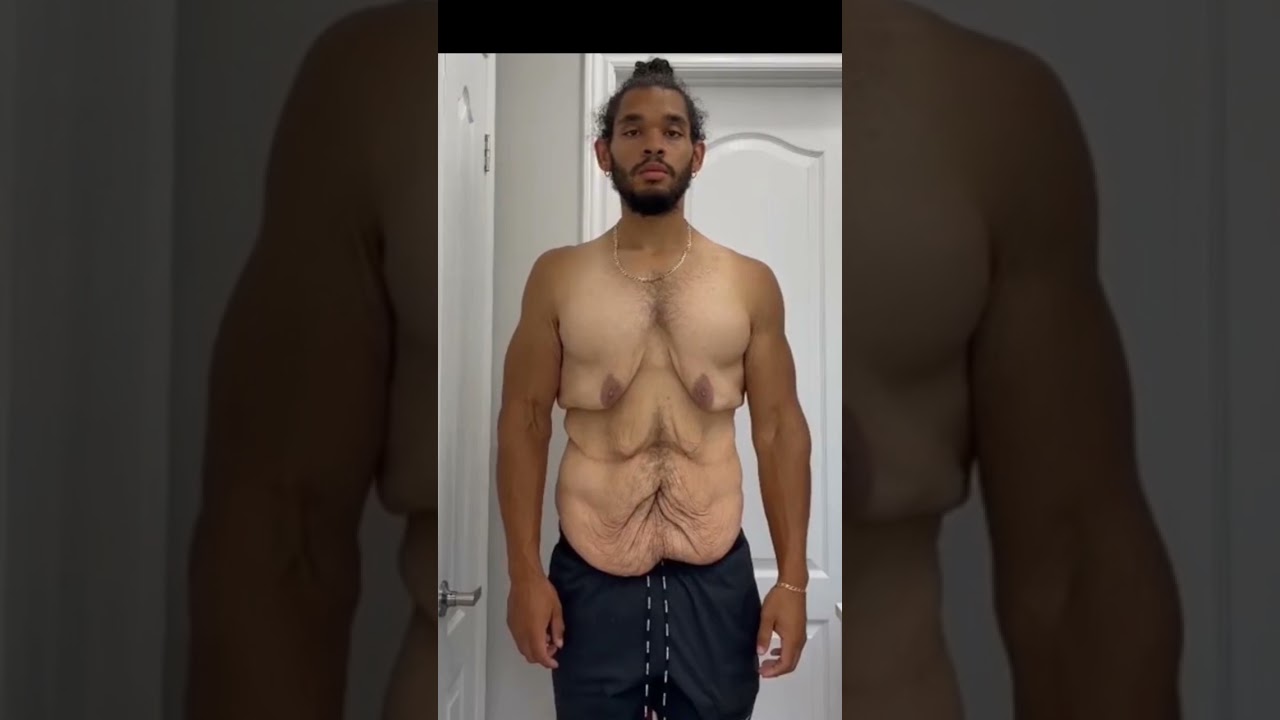 Weight Loss Transformation #SHORTS