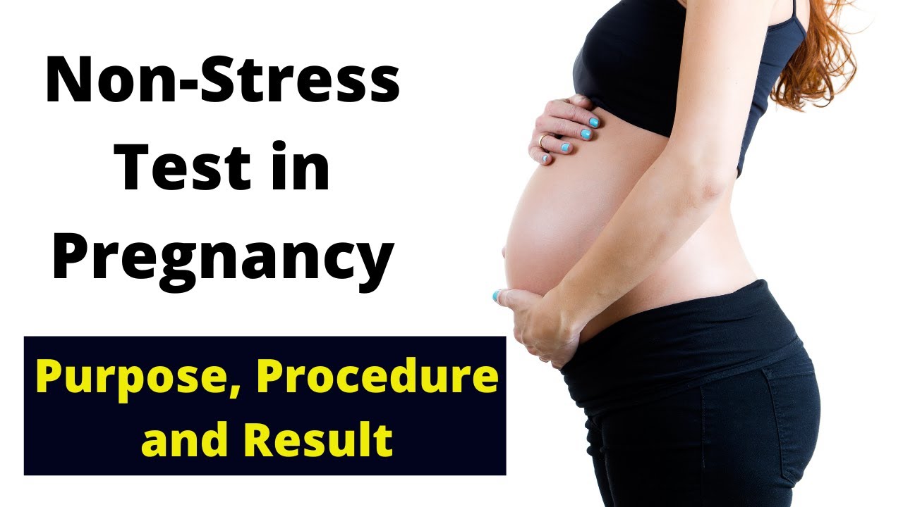What is a Non-Stress Test (NST) in Pregnancy?