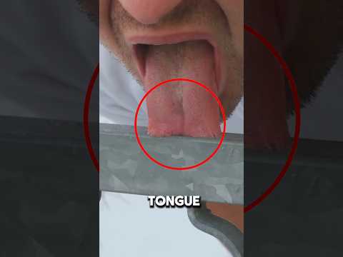 What to Do If Your Tongue Gets Stuck to a Frozen Pole!