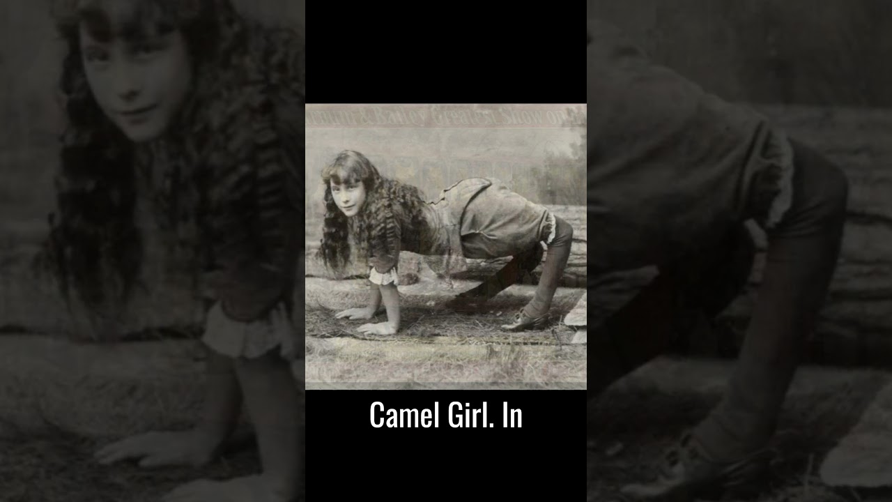 Who Was The Camel Girl? Ella Harper, The Tragic Teen Sensation #history #story #didyouknow