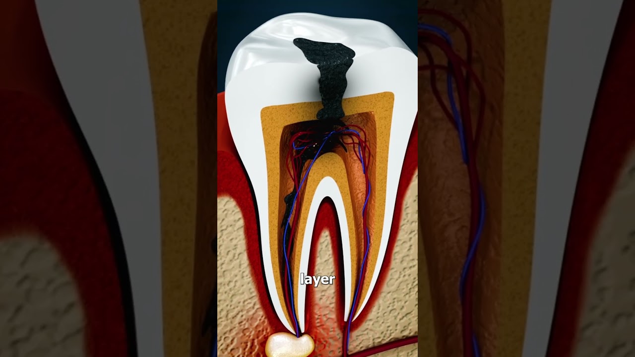 Why Grinding Your Teeth Is Bad 😱