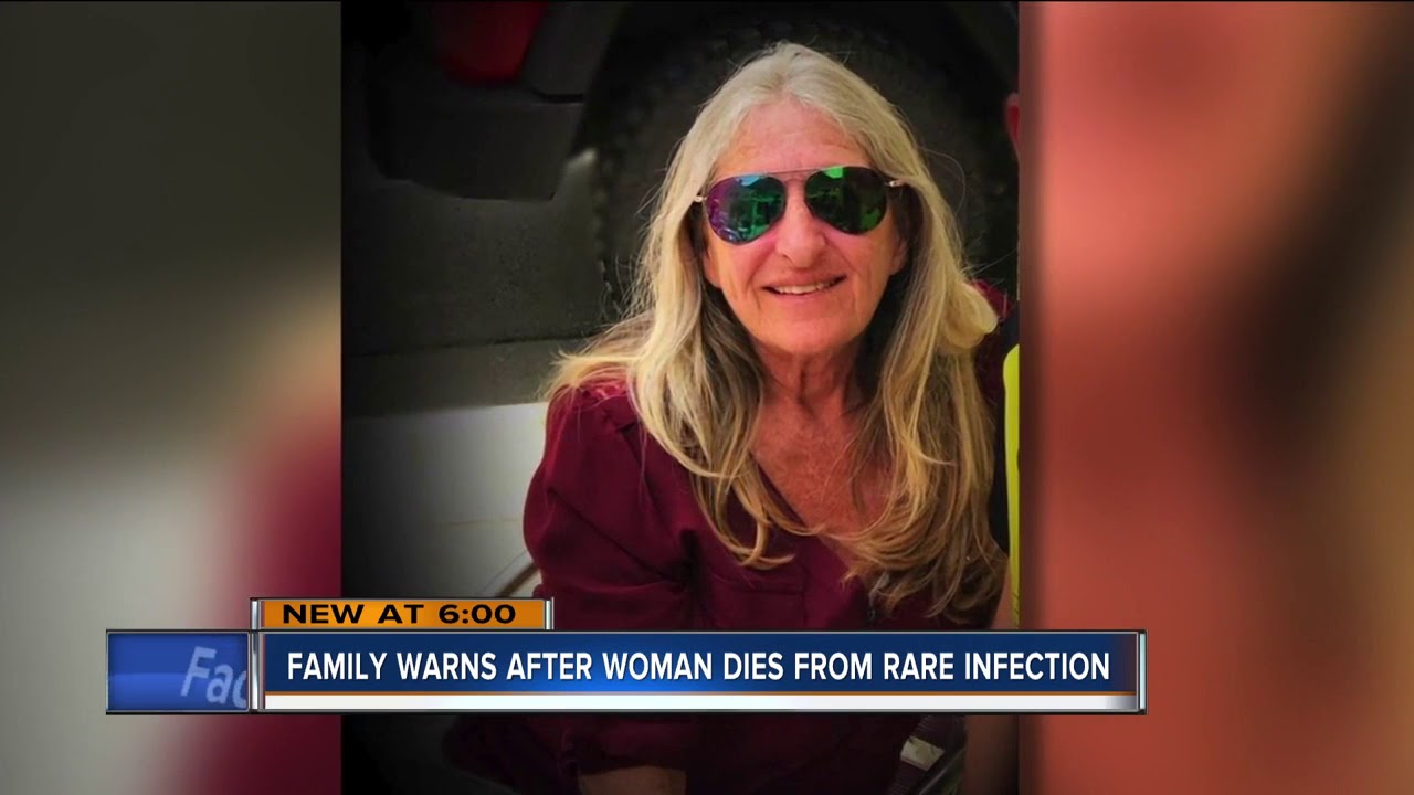Wisconsin woman dies after dog lick