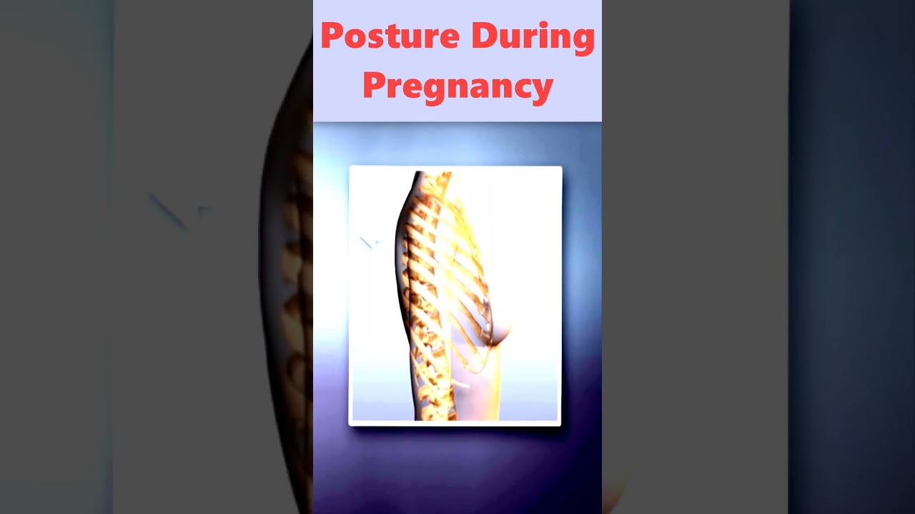 Women Posture Change During Pregnancy #shorts #pregnancy