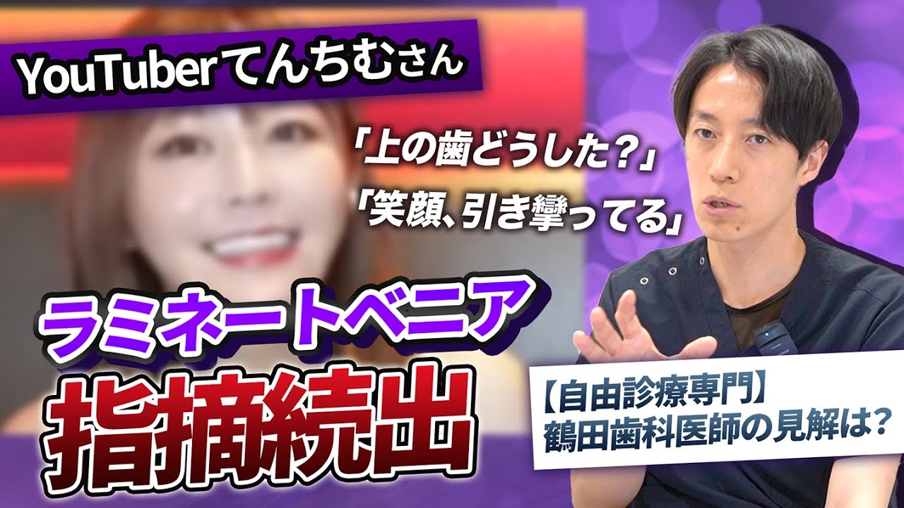 YouTuber Tenchim's cosmetic dental treatment: pros and cons!? What do private practice specialist...